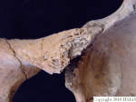 L_V20d5099 A16.175 R827 lR at ramus and acetabulum, left side.JPG L_V20d5099 A16.175 R827 lR at ramus and acetabulum, left side